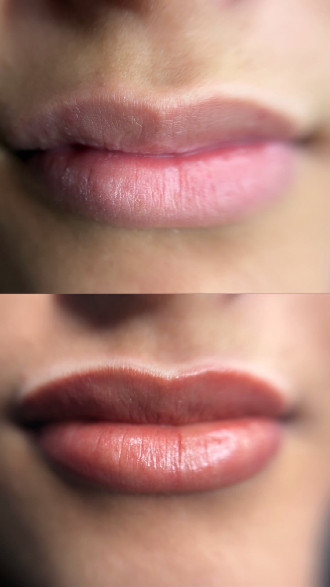 Antes y después de micropigmentación de labios en Madrid